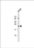 Western Blot at 1:1000 dilution + A549 whole cell lysate Lysates/proteins at 20 ug per lane.