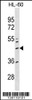 Western blot analysis in HL-60 cell line lysates (35ug/lane) .