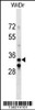 Western blot analysis in WiDr cell line lysates (35ug/lane) .