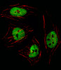 Fluorescent image of Hela cell stained with GTF2I Antibody (N-term) .Hela cells were fixed with 4% PFA (20 min) , permeabilized with Triton X-100 (0.1%, 10 min) , then incubated with GTF2I primary antibody (1:25) . For secondary antibody, Alexa Fluor 488 conjugated donkey anti-rabbit antibody (green) was used (1:400) .Cytoplasmic actin was counterstained with Alexa Fluor 555 (red) conjugated Phalloidin (7units/ml) . GTF2I immunoreactivity is localized to Nucleus significantly.