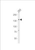 Western blot analysis in 293 cell line lysates (35ug/lane) .