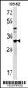 Western blot analysis in K562 cell line lysates (35ug/lane) .