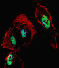 Fluorescent confocal image of Hela cell stained with RARB Antibody . Hela cells were fixed with 4% PFA (20 min) , permeabilized with Triton X-100 (0.1%, 10 min) , then incubated with RARB primary antibody (1:25) . For secondary antibody, Alexa Fluor 488 conjugated donkey anti-rabbit antibody (green) was used (1:400) .Cytoplasmic actin was counterstained with Alexa Fluor 555 (red) conjugated Phalloidin (7units/ml) . Nuclei were counterstained with DAPI (blue) (10 ug/ml, 10 min) . RARB immunoreactivity is localized to nucleus significantly.