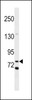 Western blot analysis in MDA-MB453 cell line lysates (35ug/lane) .