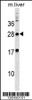 Western blot analysis in mouse liver tissue lysates (35ug/lane) .