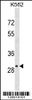 Western blot analysis in K562 cell line lysates (35ug/lane) .