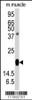 Western blot analysis of anti-RGS19 Antibody (S151) in mouse muscle tissue lysates (35ug/lane) .