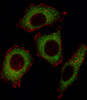 Fluorescent image of U251 cell stained with NFKBp65 Antibody (C-termS536) .U251 cells were fixed with 4% PFA (20 min) , permeabilized with Triton X-100 (0.1%, 10 min) , then incubated with NFKBp65 primary antibody (1:25) . For secondary antibody, Alexa Fluor 488 conjugated donkey anti-rabbit antibody (green) was used (1:400) .Cytoplasmic actin was counterstained with Alexa Fluor 555 (red) conjugated Phalloidin (7units/ml) .NFKBp65 immunoreactivity is localized to Cytoplasm significantly.