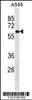 Western blot analysis in A549 cell line lysates (35ug/lane) .