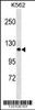 Western blot analysis in K562 cell line lysates (35ug/lane) .