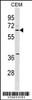 Western blot analysis in CEM cell line lysates (35ug/lane) .