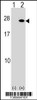 Western blot analysis of FGF19 using rabbit polyclonal FGF19 Antibody using 293 cell lysates (2 ug/lane) either nontransfected (Lane 1) or transiently transfected (Lane 2) with the FGF19 gene.