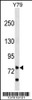 Western blot analysis in Y79 cell line lysates (35ug/lane) .