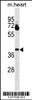 Western blot analysis in mouse heart tissue lysates (35ug/lane) .