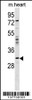 Western blot analysis in mouse heart tissue lysates (35ug/lane) .