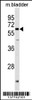 Western blot analysis in mouse bladder tissue lysates (35ug/lane) .