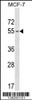 Western blot analysis in MCF-7 cell line lysates (35ug/lane) .