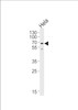 Western blot analysis of lysate from HeLa cell line, using NAP1L2 Antibody at 1:1000 at each lane.