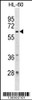 Western blot analysis in HL-60 cell line lysates (35ug/lane) .