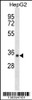 Western blot analysis in HepG2 cell line lysates (35ug/lane) .