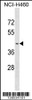 Western blot analysis in NCI-H460 cell line lysates (35ug/lane) .