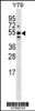 Western blot analysis in Y79 cell line lysates (35ug/lane) .