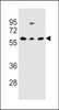 Western blot analysis in NCI-H460, 293, MDA-MB231 cell line lysates (35ug/lane) .