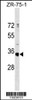 Western blot analysis in ZR-75-1 cell line lysates (35ug/lane) .