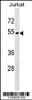 Western blot analysis in Jurkat cell line lysates (35ug/lane) .