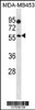 Western blot analysis in MDA-MB453 cell line lysates (35ug/lane) .