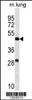 Western blot analysis in mouse lung tissue lysates (35ug/lane) .