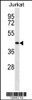 Western blot analysis in Jurkat cell line lysates (35ug/lane) .