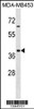 Western blot analysis in MDA-MB453 cell line lysates (35ug/lane) .