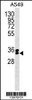 Western blot analysis in A549 cell line lysates (35ug/lane) .