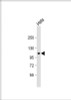 Western Blot at 1:1000 dilution + Hela whole cell lysate Lysates/proteins at 20 ug per lane.