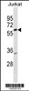 Western blot analysis in Jurkat cell line lysates (35ug/lane) .