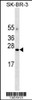 Western blot analysis in SK-BR-3 cell line lysates (35ug/lane) .