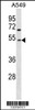 Western blot analysis in A549 cell line lysates (35ug/lane) .