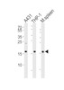 Western blot analysis of lysates from A431, THP-1 cell line and mouse spleen tissue lysate (from left to right) , using SNX3 Antibody at 1:1000 at each lane.