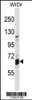 Western blot analysis in WiDr cell line lysates (35ug/lane) .