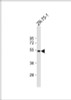 Western Blot at 1:1000 dilution + ZR-75-1 whole cell lysate Lysates/proteins at 20 ug per lane.