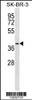 Western blot analysis in SK-BR-3 cell line lysates (35ug/lane) .