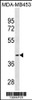 Western blot analysis in MDA-MB453 cell line lysates (35ug/lane) .