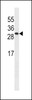 Western blot analysis in A549 cell line lysates (35ug/lane) .