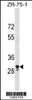 Western blot analysis in ZR-75-1 cell line lysates (35ug/lane) .