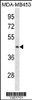 Western blot analysis in MDA-MB453 cell line lysates (35ug/lane) .