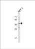 Western Blot at 1:1000 dilution + MCF-7 whole cell lysate Lysates/proteins at 20 ug per lane.