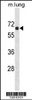 Western blot analysis in mouse lung tissue lysates (35ug/lane) .