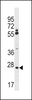 Western blot analysis in A2058 cell line lysates (35ug/lane) .