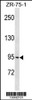 Western blot analysis in ZR-75-1 cell line lysates (35ug/lane) .